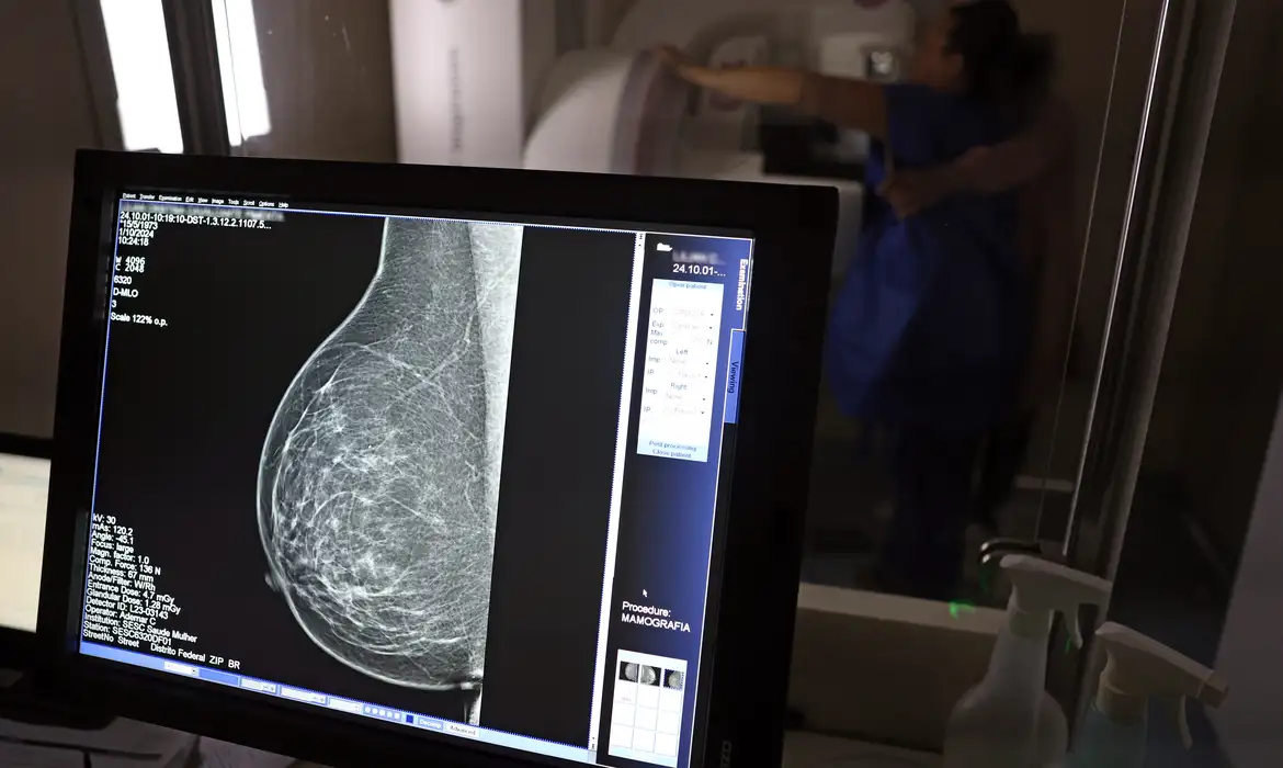 Planos de saúde ampliam cobertura e incluem mamografia digital sem limite de idade