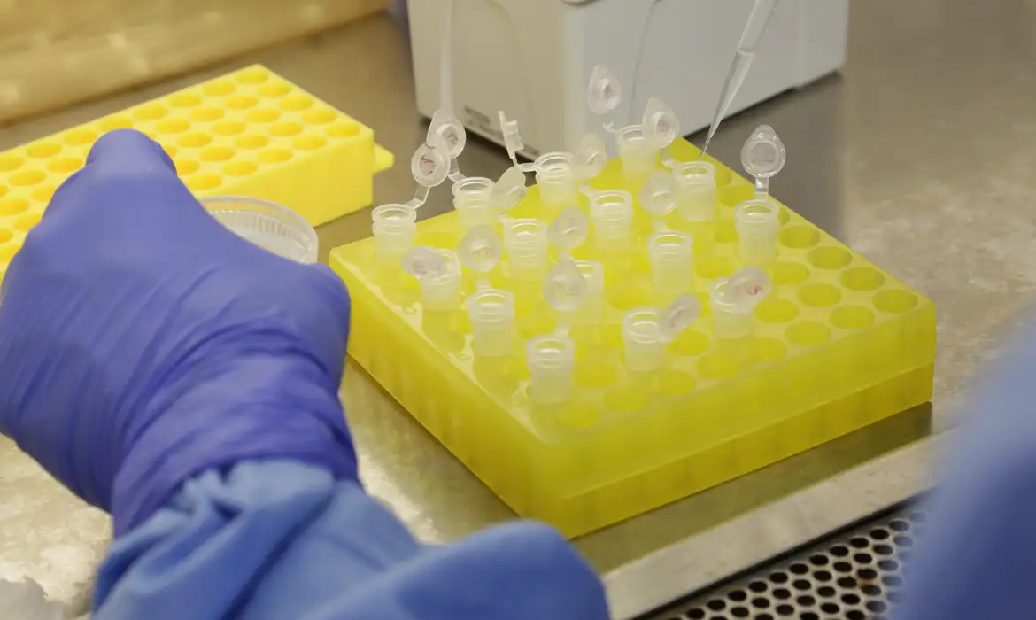 São Paulo identifica segundo caso de sarampo importado em 2026